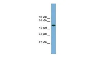 WB analysis of 293T cells using GTX45698 UBQLNL antibody at 0.2-1microg/ml. WB analysis of 293T cells using GTX45698 UBQLNL antibody at 0.2-1microg/ml.