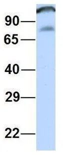 WB analysis of human fetal muscle tissue using GTX45708 CCDC52 antibody at 1.0microg/ml.