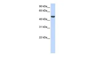 WB analysis of human fetal brain tissue using GTX45735 SPATA17 antibody at 0.2-1microg/ml. WB analysis of human fetal brain tissue using GTX45735 SPATA17 antibody at 0.2-1microg/ml.