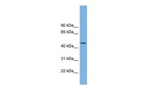 WB analysis of ACHN cells using GTX45738 MIPOL1 antibody at 0.2-1microg/ml. WB analysis of ACHN cells using GTX45738 MIPOL1 antibody at 0.2-1microg/ml.