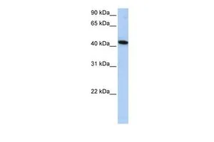 WB analysis of HepG2 cells using GTX45740 ICA1L antibody at 0.2-1microg/ml. WB analysis of HepG2 cells using GTX45740 ICA1L antibody at 0.2-1microg/ml.