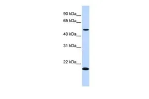 WB analysis of human fetal liver tissue using GTX45741 LOC116349 antibody at 0.2-1microg/ml. WB analysis of human fetal liver tissue using GTX45741 LOC116349 antibody at 0.2-1microg/ml.