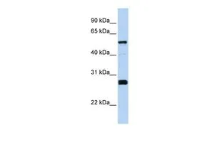 WB analysis of human brain tissue using GTX45745 FAM83F antibody at 0.2-1microg/ml. WB analysis of human brain tissue using GTX45745 FAM83F antibody at 0.2-1microg/ml.