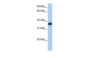 WB analysis of Jurkat cells using GTX45767 ERI2 antibody at 0.2-1microg/ml. WB analysis of Jurkat cells using GTX45767 ERI2 antibody at 0.2-1microg/ml.