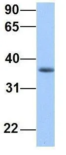 WB analysis of HepG2 cells using GTX45767 ERI2 antibody at 1.0microg/ml.