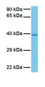 WB analysis of human fetal lung tissue using GTX45803 TXNIP antibody at 1.0microg/ml.