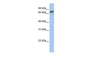 WB analysis of human fetal brain tissue using GTX45809 DYNC1I1 antibody at 0.2-1microg/ml. WB analysis of human fetal brain tissue using GTX45809 DYNC1I1 antibody at 0.2-1microg/ml.