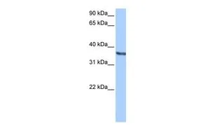 WB analysis of HepG2 cells using GTX45818 CHAD antibody at 0.2-1microg/ml. WB analysis of HepG2 cells using GTX45818 CHAD antibody at 0.2-1microg/ml.