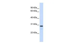 WB analysis of human B lymphoblast cells using GTX45837 FAM78B antibody at 0.2-1microg/ml. WB analysis of human B lymphoblast cells using GTX45837 FAM78B antibody at 0.2-1microg/ml.