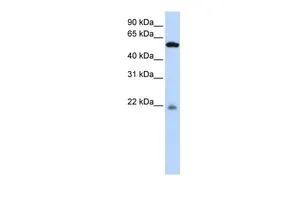 WB analysis of human B lymphoblast cells using GTX45840 PM20D2 antibody at 0.2-1microg/ml. WB analysis of human B lymphoblast cells using GTX45840 PM20D2 antibody at 0.2-1microg/ml.