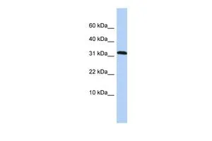 WB analysis of HepG2 cells using GTX45845 DYSFIP1 antibody at 0.2-1microg/ml. WB analysis of HepG2 cells using GTX45845 DYSFIP1 antibody at 0.2-1microg/ml.
