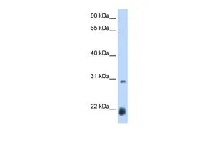 WB analysis of Drosophila lysate using GTX45854 AC antibody at 0.2-1microg/ml. WB analysis of Drosophila lysate using GTX45854 AC antibody at 0.2-1microg/ml.