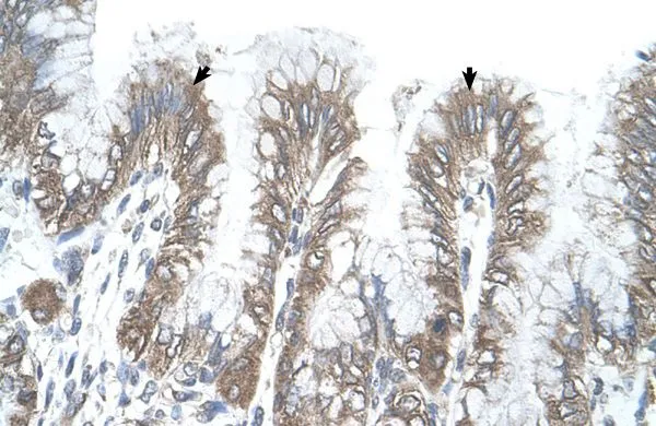IHC-P analysis of human stomach tissue using GTX45867 RSRC2 antibody at 4.0-8.0microg/ml. IHC-P analysis of human stomach tissue using GTX45867 RSRC2 antibody at 4.0-8.0microg/ml.