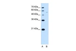 WB analysis of Jurkat cells using GTX45867 RSRC2 antibody at 2.5microg/ml. Lane A : marker Lane B : Jurkat cells