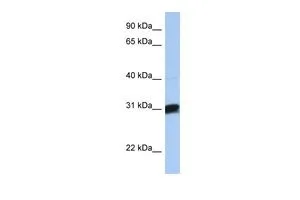 WB analysis of human brain tissue using GTX45882 B3GALT6 antibody at 0.2-1microg/ml. WB analysis of human brain tissue using GTX45882 B3GALT6 antibody at 0.2-1microg/ml.