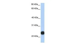 WB analysis of human placenta tissue using GTX45892 TMEM123 antibody at 0.2-1microg/ml. WB analysis of human placenta tissue using GTX45892 TMEM123 antibody at 0.2-1microg/ml.