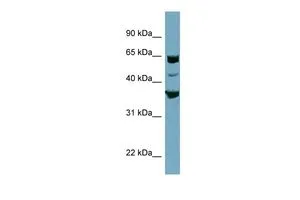 WB analysis of PANC1 cells using GTX45915 SEC22C antibody at 0.2-1microg/ml. WB analysis of PANC1 cells using GTX45915 SEC22C antibody at 0.2-1microg/ml.
