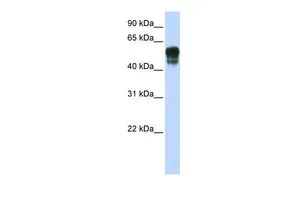 WB analysis of tranfected 293T cells using GTX45931 SPNS1 antibody at 0.2-1microg/ml. WB analysis of tranfected 293T cells using GTX45931 SPNS1 antibody at 0.2-1microg/ml.