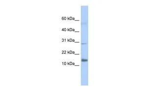 WB analysis of tranfected 293T cells using GTX45933 FAM14A antibody at 0.2-1microg/ml. WB analysis of tranfected 293T cells using GTX45933 FAM14A antibody at 0.2-1microg/ml.