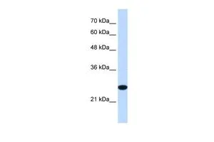 WB analysis of Jurkat cells using GTX45988 TMEM109 antibody at 1.25microg/ml. WB analysis of Jurkat cells using GTX45988 TMEM109 antibody at 1.25microg/ml.