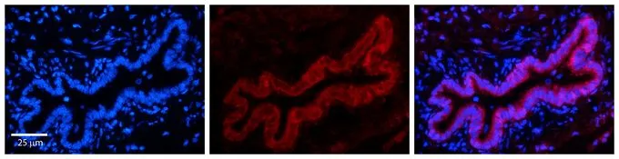 IHC-P analysis of human bronchial epithelial tissue using GTX45996 TMEM135 antibody at 1:100. Left to right : DAPI, TMEM135, Merge. Low pH, heat-induced antigen retrieval method utilizing Sodium Citrate buffer was performed. IHC-P analysis of human bronchial epithelial tissue using GTX45996 TMEM135 antibody at 1:100. Left to right : DAPI, TMEM135, Merge. Low pH, heat-induced antigen retrieval method utilizing Sodium Citrate buffer was performed.