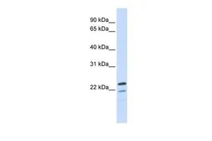 WB analysis of human brain tissue using GTX45998 REEP1 antibody at 0.2-1ug/ml.