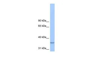 WB analysis of HeLa cells using GTX46008 LPPR2 antibody at 0.2-1microg/ml. WB analysis of HeLa cells using GTX46008 LPPR2 antibody at 0.2-1microg/ml.