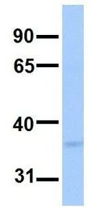 WB analysis of human fetal brain tissue using GTX46008 LPPR2 antibody at 1microg/ml.