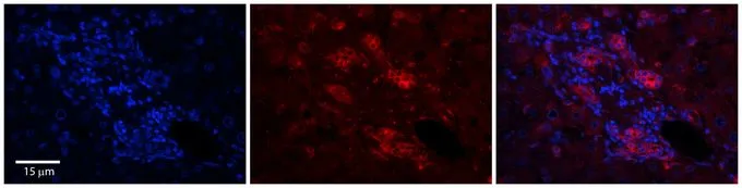 IHC-P analysis of human liver tissue using GTX46018 C11ORF24 antibody at 1:100. Left to right:DAPI, C11orf24, Merge. Low pH, heat-induced antigen retrieval method utilizing Sodium Citrate buffer was performed. IHC-P analysis of human liver tissue using GTX46018 C11ORF24 antibody at 1:100. Left to right:DAPI, C11orf24, Merge. Low pH, heat-induced antigen retrieval method utilizing Sodium Citrate buffer was performed.