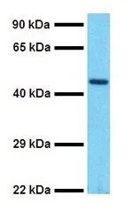 WB analysis of MCF-7 cells using GTX46041 SOX5 antibody at 1microg/ml. WB analysis of MCF-7 cells using GTX46041 SOX5 antibody at 1microg/ml.