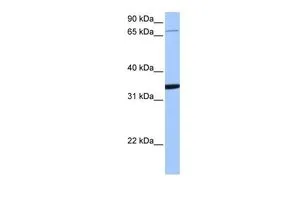 WB analysis of Jurkat cells using GTX46082 PCDHA10 antibody at 0.2-1microg/ml. WB analysis of Jurkat cells using GTX46082 PCDHA10 antibody at 0.2-1microg/ml.