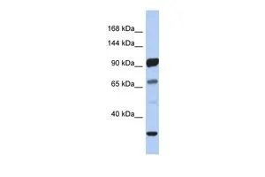 WB analysis of human fetal stomach tissue using GTX46083 PCDHA10 antibody at 0.2-1microg/ml. WB analysis of human fetal stomach tissue using GTX46083 PCDHA10 antibody at 0.2-1microg/ml.