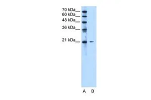 WB analysis of Jurkat cells using GTX46085 C20ORF24 antibody at 2.5microg/ml. Lane A : marker Lane B : Jurkat cells WB analysis of Jurkat cells using GTX46085 C20ORF24 antibody at 2.5microg/ml. Lane A : marker Lane B : Jurkat cells