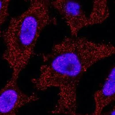 ICC/IF analysis of HeLa cells using GTX46123 p73 antibody [5B429]. Red : primary antibody Blue : DAPI Dilution : 3 ug/mL