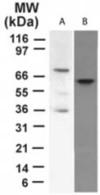 WB analysis of (A)HeLa overexpressing p73 (B) HeLa mock cell lysate using GTX46123 p73 antibody [5B429]. Dilution : 2 microg/ml