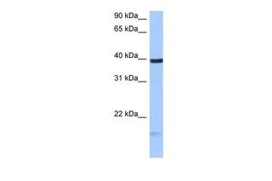 WB analysis of MCF-7 cells using GTX46133 HS3ST5 antibody at 0.2-1microg/ml. WB analysis of MCF-7 cells using GTX46133 HS3ST5 antibody at 0.2-1microg/ml.