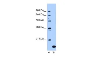 WB analysis of Jurkat cells using GTX46161 NAT13 antibody at 1.25microg/ml. Lane A : marker Lane B : Jurkat cells WB analysis of Jurkat cells using GTX46161 NAT13 antibody at 1.25microg/ml. Lane A : marker Lane B : Jurkat cells
