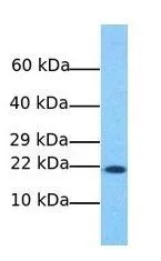 WB analysis of MCF-7 cells using GTX46161 NAT13 antibody at 1microg/ml.