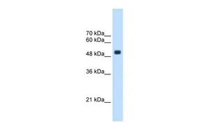 WB analysis of HepG2 cells using GTX46162 CXORF34 antibody at 2.5microg/ml. WB analysis of HepG2 cells using GTX46162 CXORF34 antibody at 2.5microg/ml.