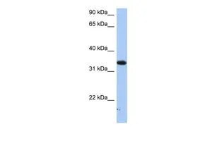 WB analysis of HepG2 cells using GTX46218 SULT6B1 antibody at 0.2-1microg/ml. WB analysis of HepG2 cells using GTX46218 SULT6B1 antibody at 0.2-1microg/ml.