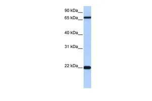 WB analysis of Jurkat cells using GTX46219 ACCSL antibody at 0.2-1microg/ml. WB analysis of Jurkat cells using GTX46219 ACCSL antibody at 0.2-1microg/ml.