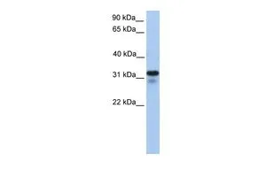 WB analysis of human B lymphoblast cells using GTX46226 HS3ST6 antibody at 0.2-1microg/ml. WB analysis of human B lymphoblast cells using GTX46226 HS3ST6 antibody at 0.2-1microg/ml.