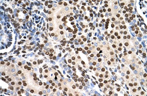 IHC-P analysis of human kidney tissue using GTX46246 RSU1 antibody at 4.0-8.0microg/ml. IHC-P analysis of human kidney tissue using GTX46246 RSU1 antibody at 4.0-8.0microg/ml.