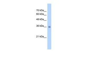IHC-P analysis of human kidney tissue using GTX46246 RSU1 antibody at 4.0-8.0ug/ml.