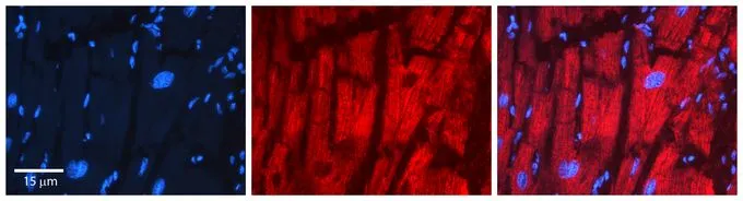 IHC-P analysis of human heart tissue using GTX46256 PDHB antibody at 1:100. Left to right:DAPI, PDHB, Merge. Low pH, heat-induced antigen retrieval method utilizing Sodium Citrate buffer was performed. IHC-P analysis of human heart tissue using GTX46256 PDHB antibody at 1:100. Left to right:DAPI, PDHB, Merge. Low pH, heat-induced antigen retrieval method utilizing Sodium Citrate buffer was performed.