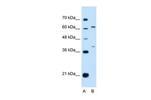 WB analysis of HepG2 cells using GTX46260 IL28RA antibody at 0.2-1microg/ml. Lane A : marker Lane B : HepG2 cells WB analysis of HepG2 cells using GTX46260 IL28RA antibody at 0.2-1microg/ml. Lane A : marker Lane B : HepG2 cells