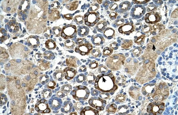 IHC-P analysis of human kidney tissue using GTX46264 ST14 antibody at 4.0-8.0microg/ml. IHC-P analysis of human kidney tissue using GTX46264 ST14 antibody at 4.0-8.0microg/ml.
