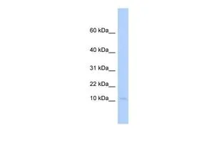 WB analysis of human fetal heart tissue using GTX46275 PLAC9 antibody at 0.2-1microg/ml. WB analysis of human fetal heart tissue using GTX46275 PLAC9 antibody at 0.2-1microg/ml.
