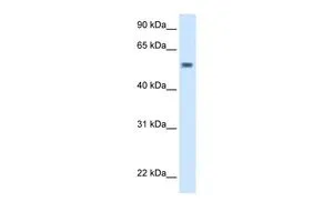 WB analysis of Drosophila lysate using GTX46279 EXD antibody at 5.0microg/ml. WB analysis of Drosophila lysate using GTX46279 EXD antibody at 5.0microg/ml.