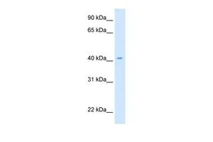 WB analysis of Drosophila lysate using GTX46288 CAD antibody at 0.2-1microg/ml. WB analysis of Drosophila lysate using GTX46288 CAD antibody at 0.2-1microg/ml.